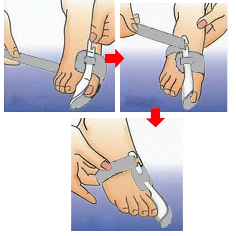 2Pcs=1 Pair Big Toes Separator Bunion Adjuster Foot Care Tools Pain Relief Hallux Valgus Corrector Orthosis Bone Straightener