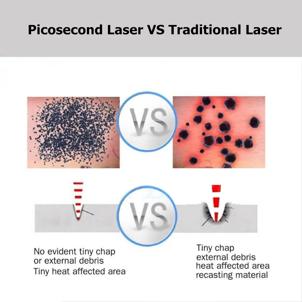 Портативный мини синий светильник, лазерная пикосекундная ручка, черная, красная татуировка для удаления рубцов от акне, Крот, веснушки, темное пятно, удаление черного пигмента