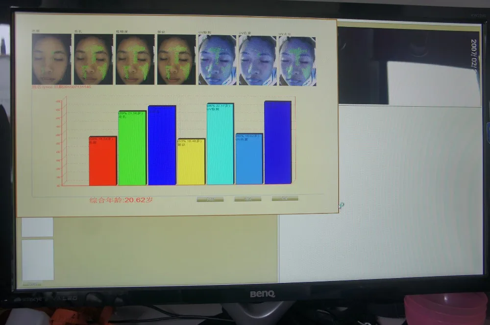 Magic-crystal_skin analyzer (3).JPG