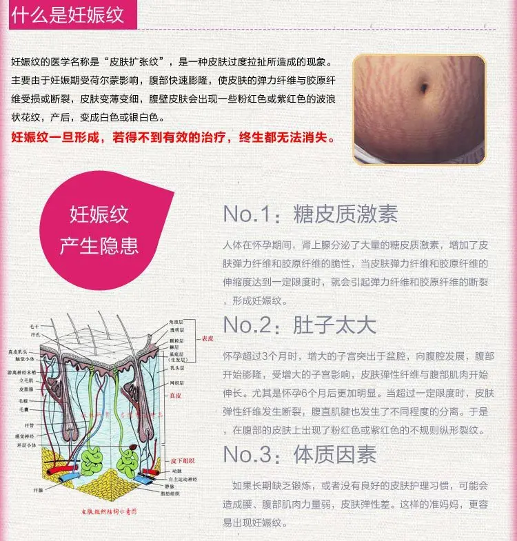 1 шт. кожи крем для тела удалить стрейч Знаки лечения послеродовой ремонт отбеливающий крем Беременность шрама