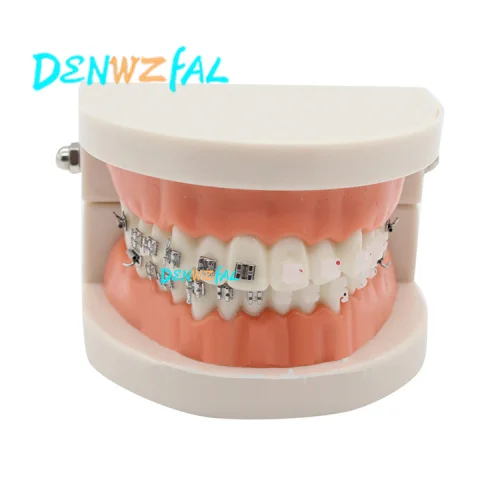 Новая Ортодонтическая модель для стоматологической 1/2 стандартная стоматология с полуметаллический кронштейны половина керамический кронштейн модель зубов - Цвет: Зеленый