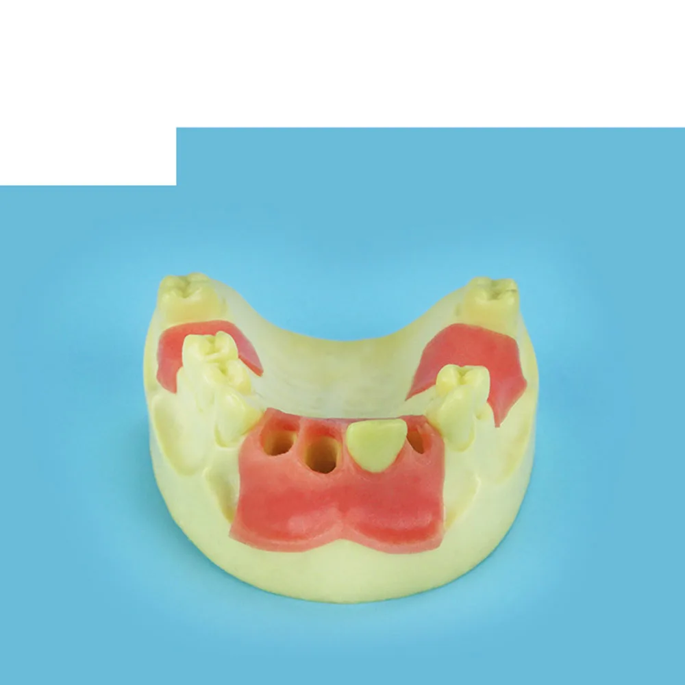 Оральная модель, maxillary anterior отсутствует для тренировки имплантации модели, модель зубного импланта