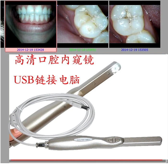 Dental Endoscope Dental Endoscope Internal Camera High Definition USB