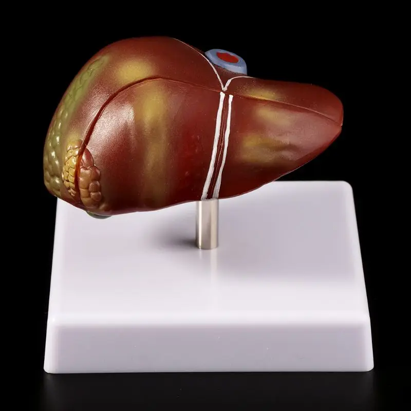 2019 новая человеческая печень патологическая анатомическая модель Анатомия школьная медицинская учебная демонстрация инструмент