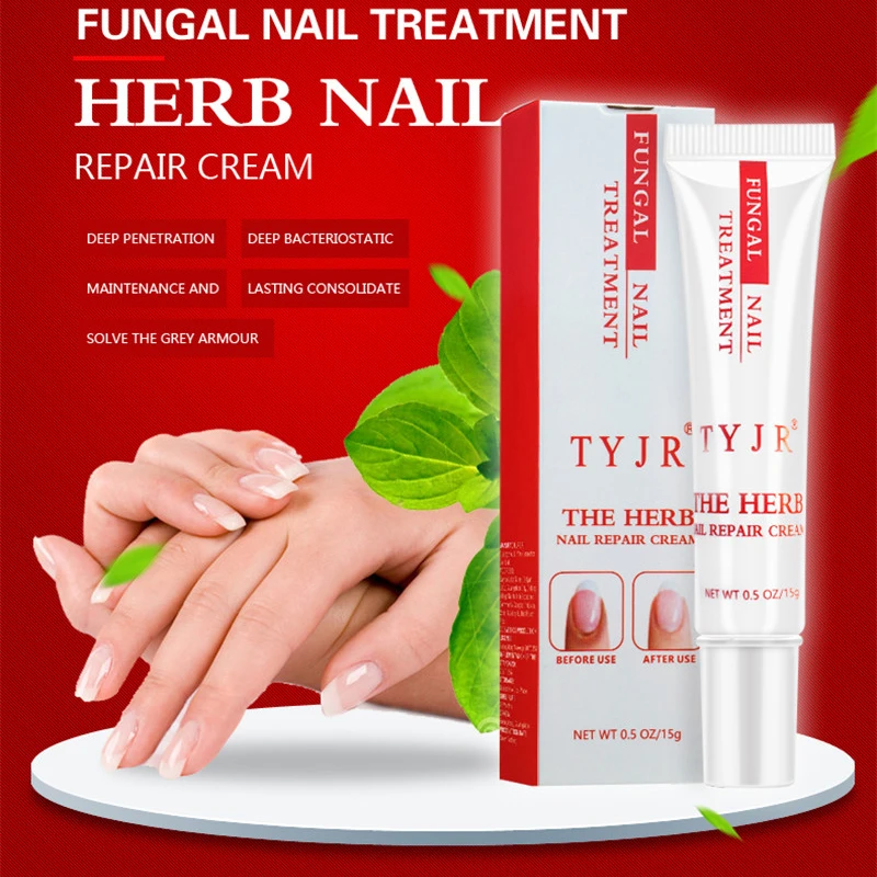 Expensive Price for  Fungal Nail Treatments Essence Nail and Foot Whitening Repair Cream Cuticle Toe Nail Fungus Removal