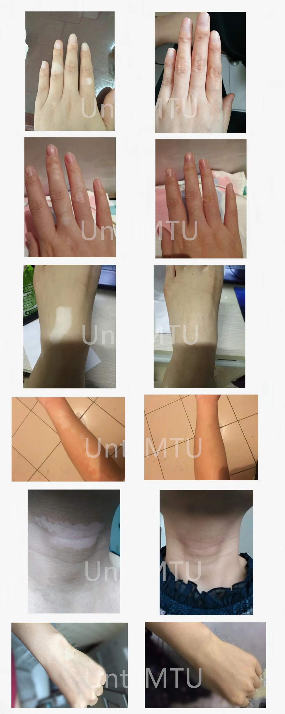 UNTILMTU