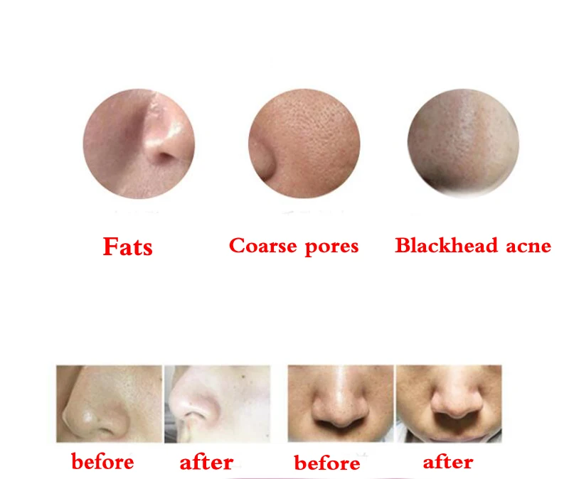 Mini Silicone Electric Facial Brush (9)