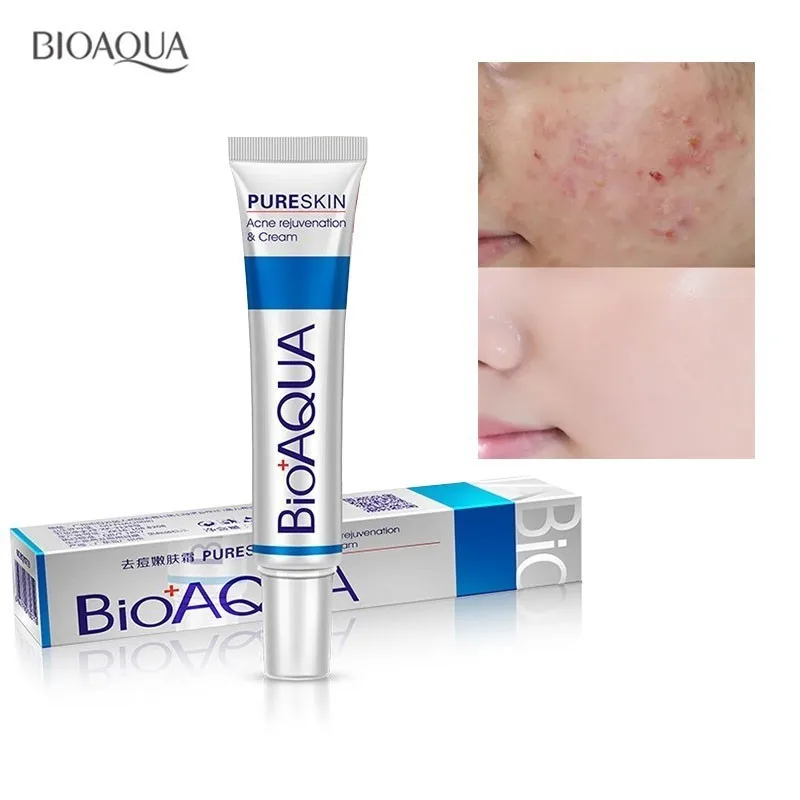 5 шт./лот лечение акне Bioaqua Удаление угрей крем против контроль жирности