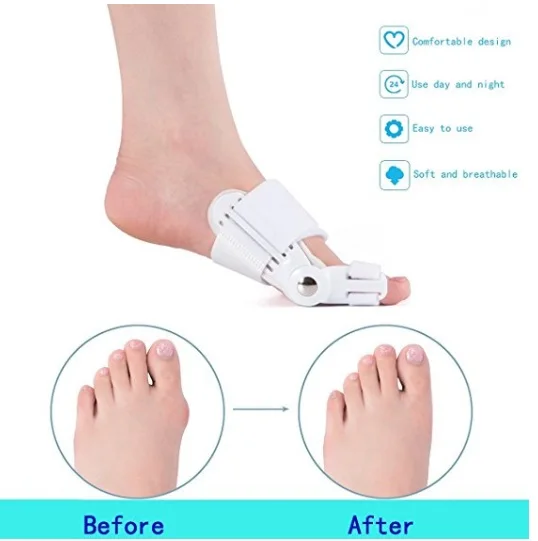 Bunion Corrector, Hallux Valgus Bunion brace Splint Pads for Foot