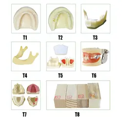 Зубной имплантат модели для имплантата практика, Bone челюсти зубы модель