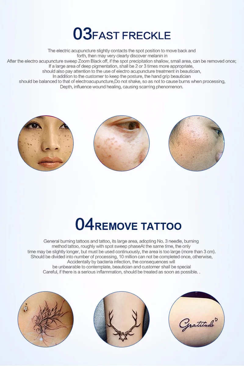 tattoo-removal-machine-12