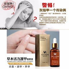 Оригинальное Лечение ногтей от грибка эссенция для ногтей и отбеливающий ножной гриб