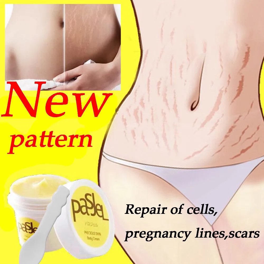 

Striae Gravidarum Repair Cream New Pattern Removal Stretch Marks Cream Fat Scar Striae Gravidarum Treatment 50g Repair Cream New