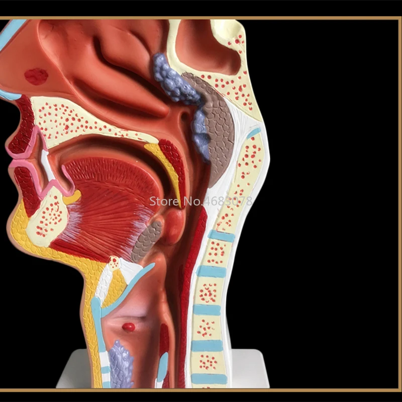 Нормальная/патологическая анатомическая модель носоглоточной полости в носовой полости и горле человеческого тела 24x12x12 см