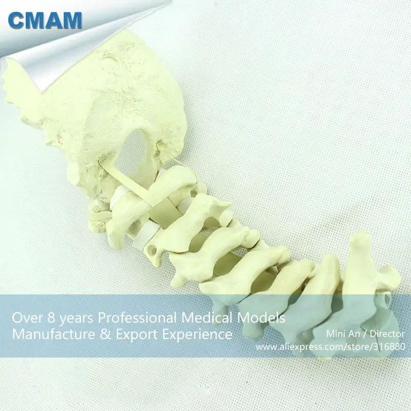 CMAM-TF11 Normal Anatomy Orthopaedic Models Cervical Spine with Occipital