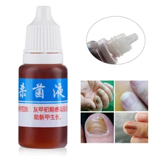 Лечение грибка для ног и ногтей против грибковой инфекции ногтей, удаление эссенции, уход за чистыми грибок ногтей, лечение онихомикоза