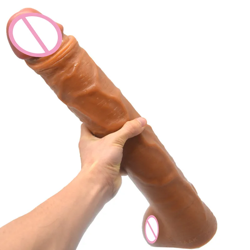 S (4)