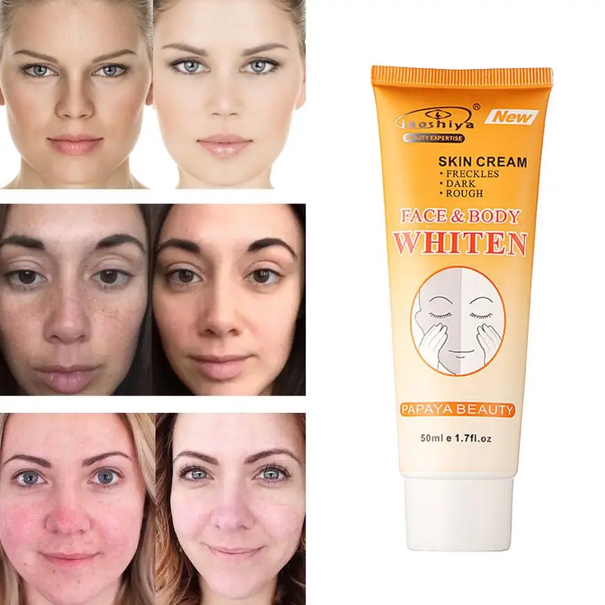 

Whitening Cream For Armpit Elbow Knee Lightening BIKINI-Underarm Inner Thigh 8.7