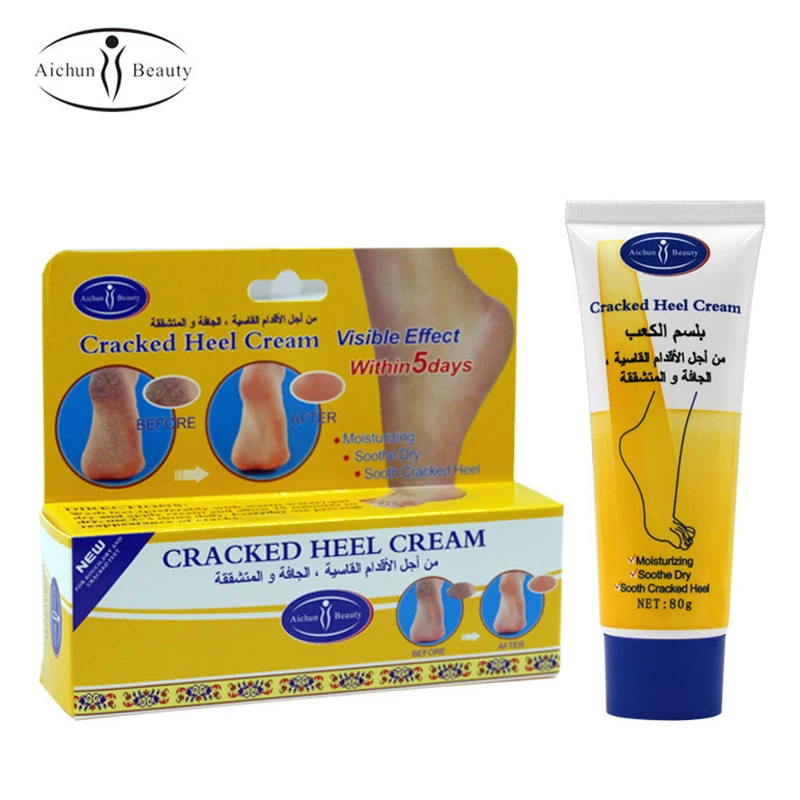 cracked heel lotion