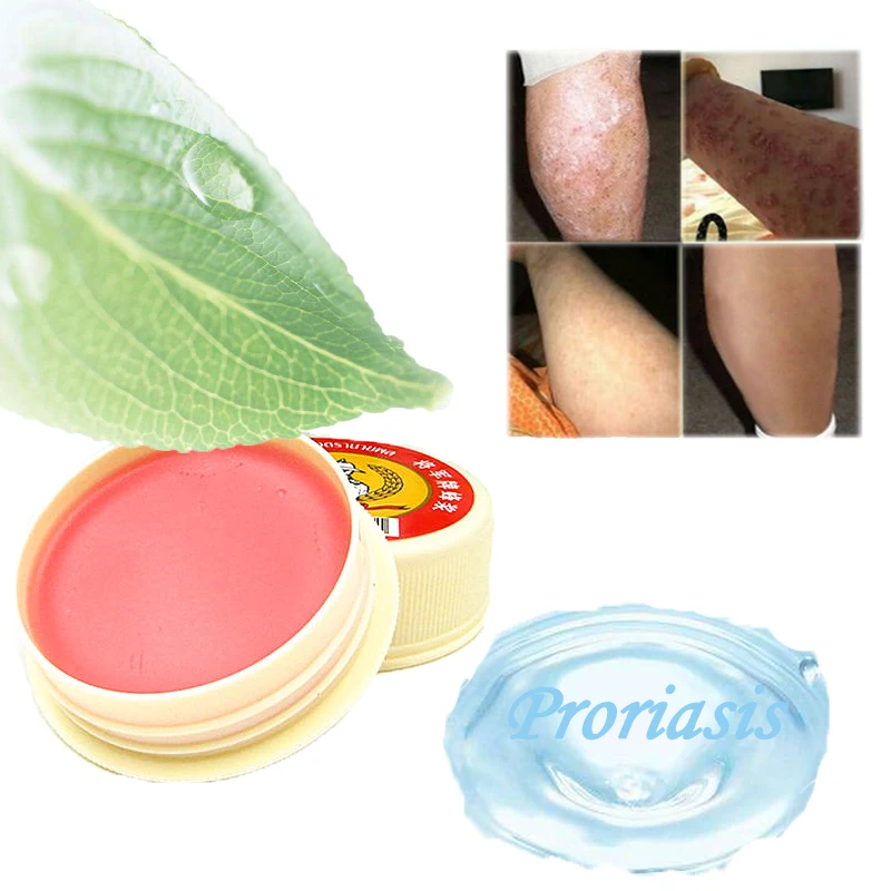 Профессиональный мазь для лечения псориаза, из Тайланда, природный медицинский ингредиент, безопасный крем для кожи