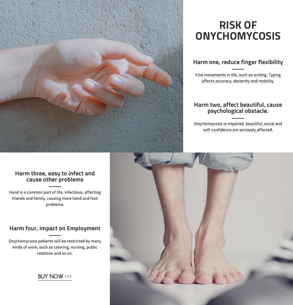 Firstsun 4ML Nail Nutrient Pen Removes Fungus Nail Repair Liquid Bright Nail Bio-Protective Film Nail Care TSLM2