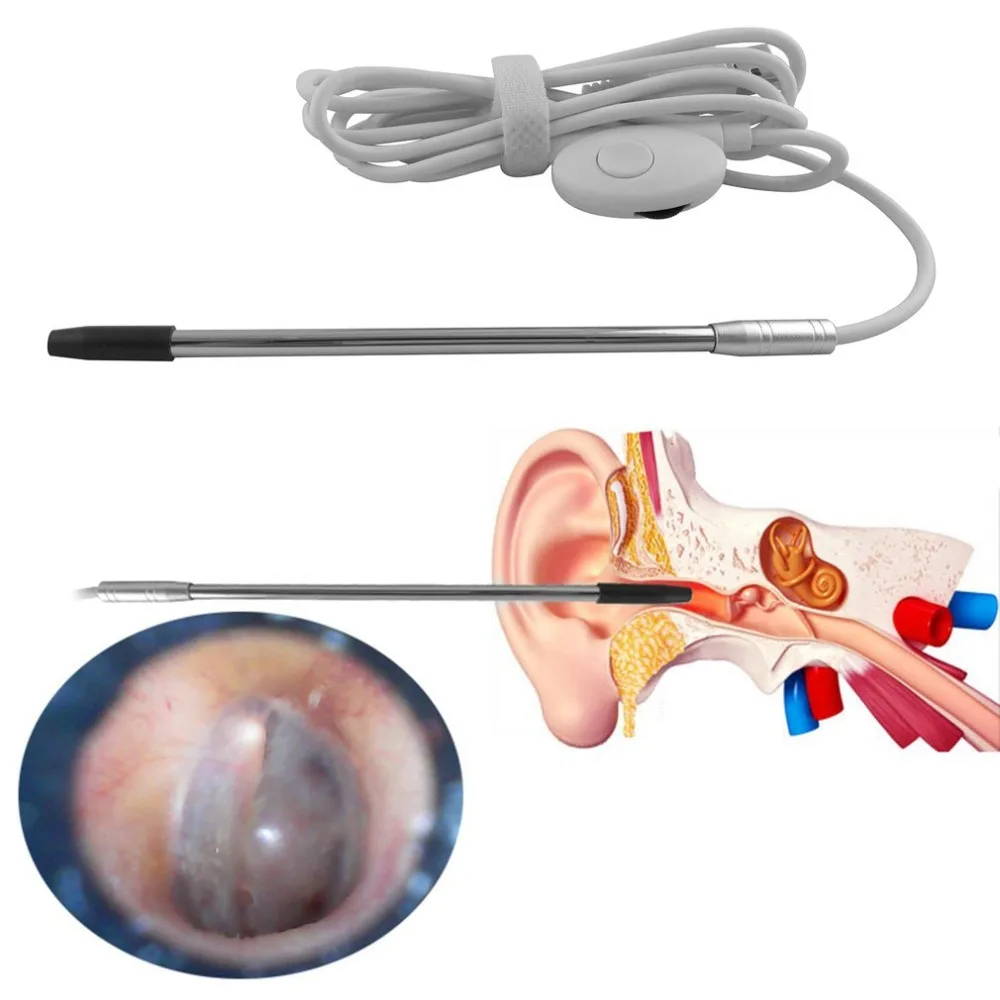 

Mini 2.0 Digital Medical USB Endoscope 4.9MM Lens Ear Endoscope Borescope Earwax Removal Inspection Tool US plug