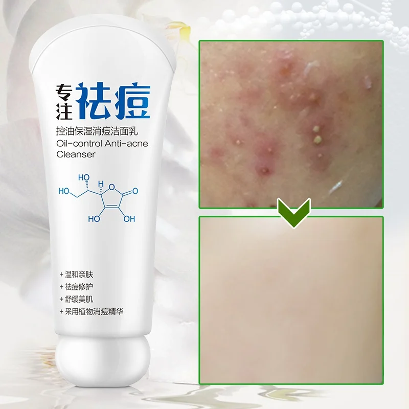 Горячая угольная маска для очищения лица, контроль жирности, глубоко очищающая пена, уменьшает поры, очищение, лечение акне уход за лицом очищающее средство для ухода за лицом