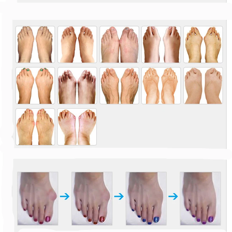 Separador do Dedo do pé Pares Ortopedia Polegar Joanete Corrector Toe Silicone Pedicure Protetor Hálux Valgo Ajustador 45 9 Protetor Protetor Hálux Valgo Joanete Ajustador