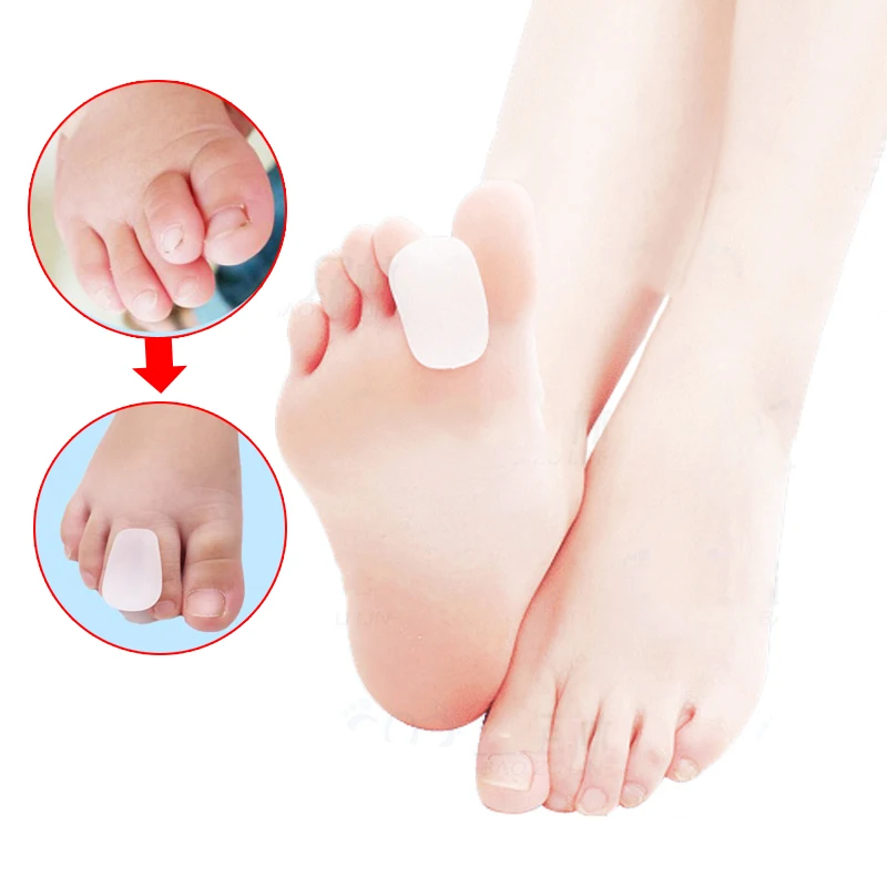 

2 Pair Foot Care Tool Soft Silicone Gel Toe Separators Bunion Straightener Protector Bone Thumb Hallux Valgus Corrector Adjuster