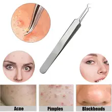Средство для удаления черных точек, 1 шт., изогнутые клипсы для акне прыщей, инструмент для удаления комедона, средство для очистки лица