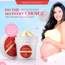 Крем для ухода за кожей для беременных Крем Для Удаления растяжек шрам крем от прыщей уход Послеродовая Сыворотка для беременных гладкие кремы для кожи 9