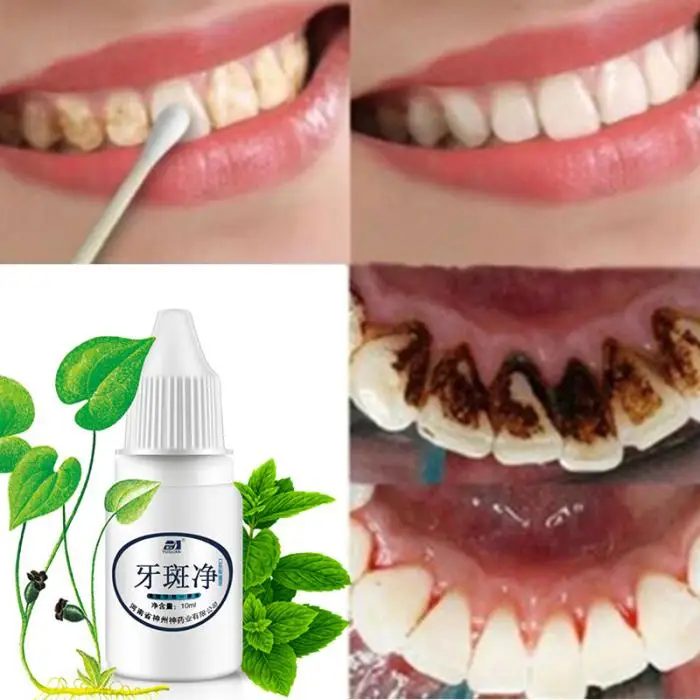 Отбеливающая жидкость для зубов Гигиена полости рта очищающая жидкость для ухода за зубами CD88