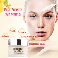 Dimollaure Strong effect whitening cream 20g Removal Freckle melasma pigment Melanin sunburn Pregnancy spots Acne brown Spots