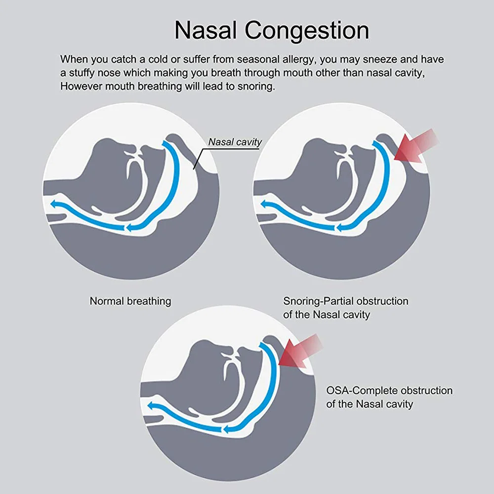 3 шт. Носовые расширители против храпа для уменьшения храпа для улучшения дыхания и сна забота о здоровье