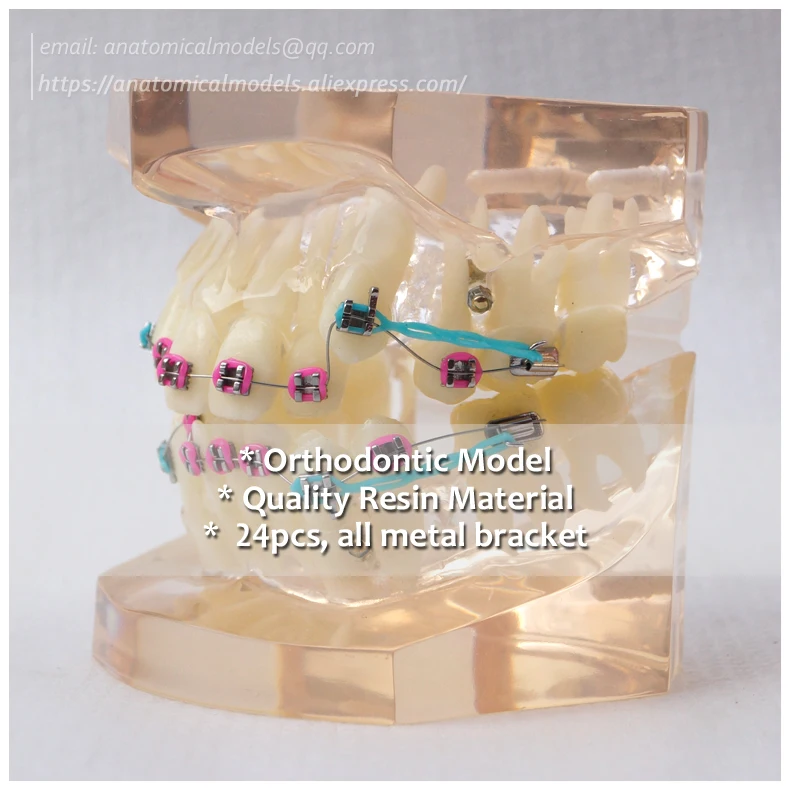

No.13047, Clear Orthodontic Model, Dentist Transparent Oral Dental Ortho Metal Bracket, China Medical Anatomical Model