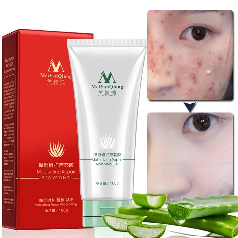 

Moisturizing Repair Aloe Vera Gel Skin Care Anti-wrinkle Soothing Nourishing Natural Plant Extracts Blemishes Treatment Cream