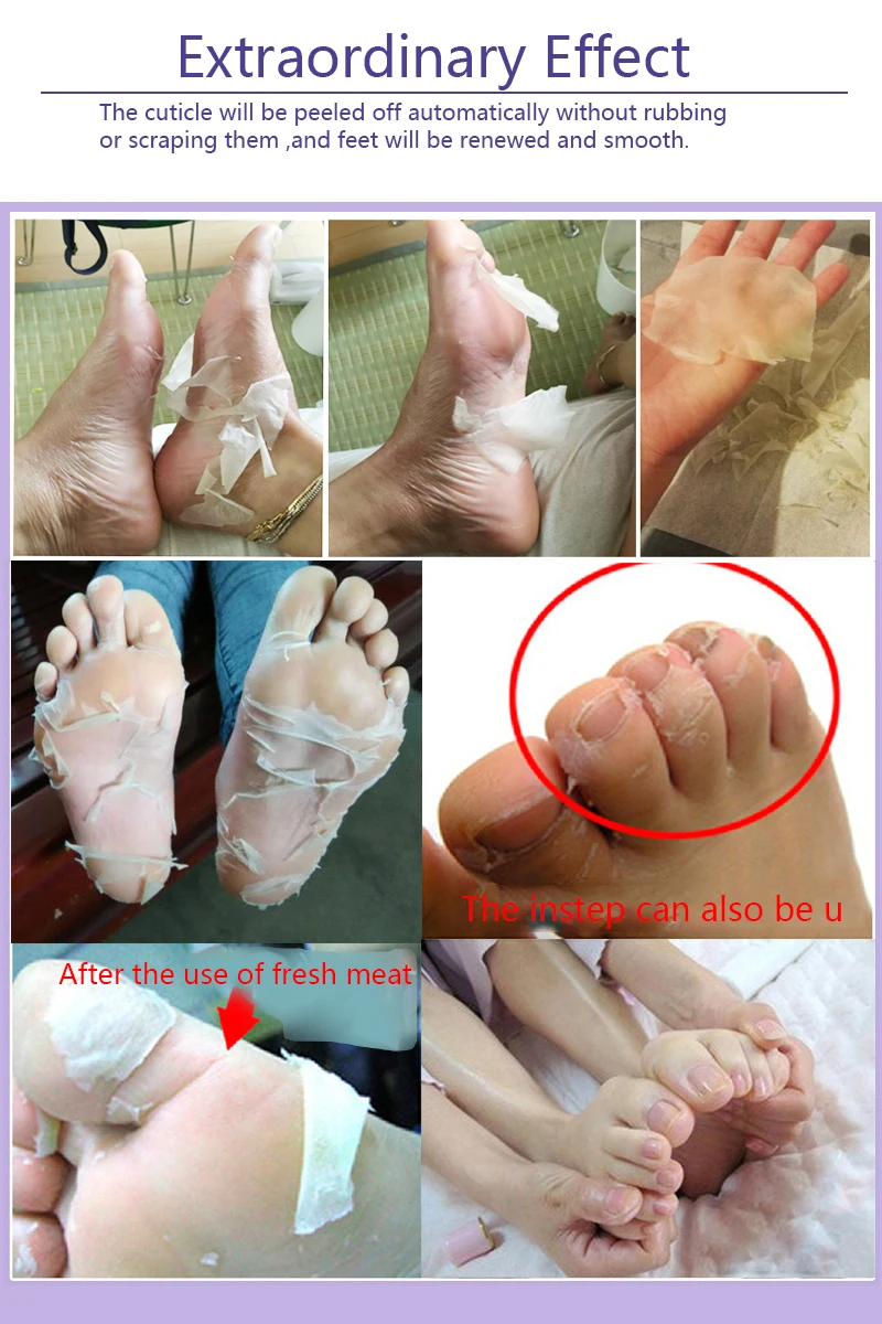 Efero 5 пар = 10 шт. детские ножки отшелушивающая маска для ног кожа пилинг мертвая кожа ноги носки с масками Sosu носки для педикюра крем для ног