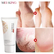 Meiking Baby Уход за ногами глубокое Отшелушивание для ног очищение от сухости удаление мертвой кожи лосьон для ног Отшелушивающий крем маска для ног 80 г