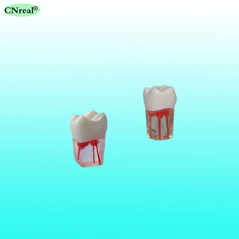 5 шт./компл. ендодонтик практика модель зубов для RCT прозрачный смолы с окрашенная корневого канала