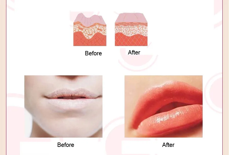 Lip Plumper Crystal Collagen Lip Mask Pads Moisture Essence Anti Ageing Wrinkle Patch Pad Gel Full Lips Lip Enhancer