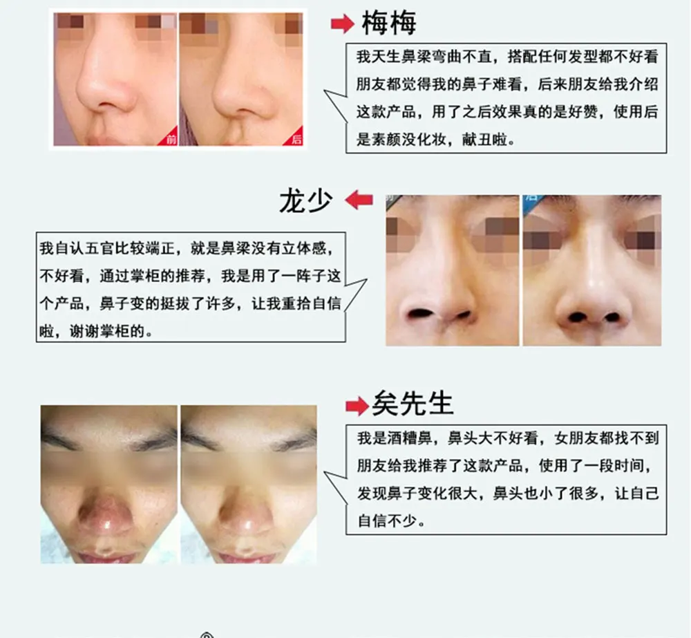 Эффективный бренд, не хирургический мощный Ремоделирование носовой кости, тонкий нос, подтягивающий крем, термоусадочное эфирное масло для носа, 10 мл