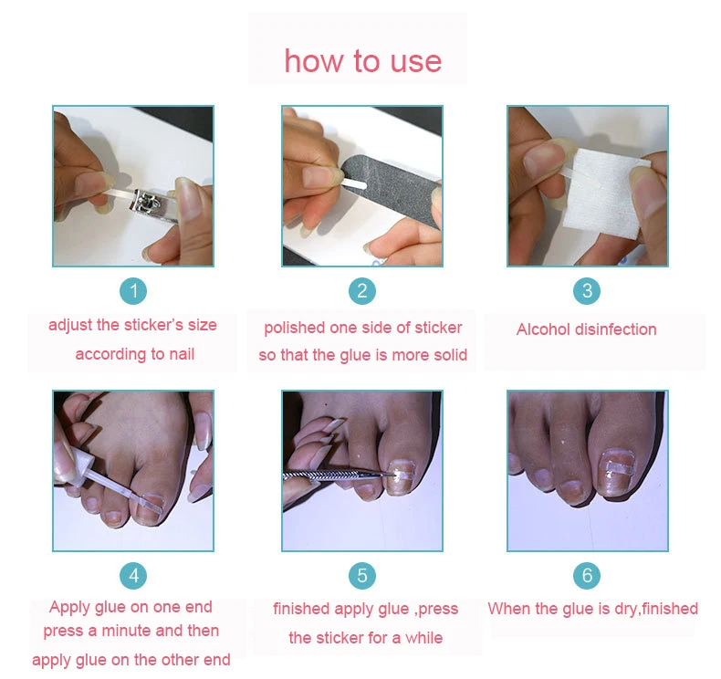TOE NAIL CORRECTION STICKER PATCH 2 NEW-10pcs-box-Ingrown-Toe-Nail-Correction-Sticker-Patch-Paronychia-Correction-File-Acronyx-Wire-Corrector-Foot1