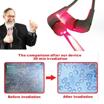 

Tinnitus Laser Therapeutic Rhinitis Sinusitis Allergic Rhinitis Hearing Aids Watch Laser Therapy Medical Device