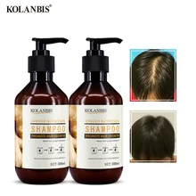 Имбирный шампунь истончение волос укрепляет лечение густой ускоренный рост волос против перхоти натуральное жирное средство против выпадения волос