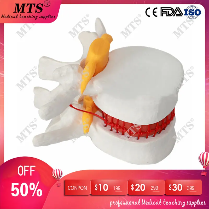 

Human anatomy skeleton Spine Lumbar Disc Herniation Teaching Model medical instrume traumatic pistol spinal bone pathology model