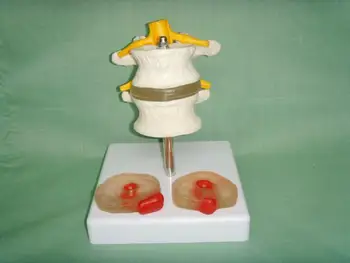 

lumbar vertebrae bone model intervertebral disc model