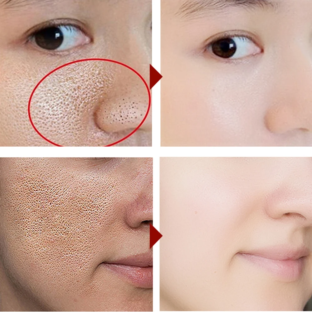 MABREM Skin Care Serum Lactobionic Acid VC Tender Serum Repair Essence Shrink Pore Face Skin Care Serum