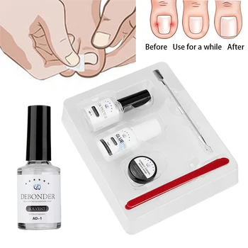 

10pcs /set Elastic Patch Straightening Clip Brace with Glue Pedicure Tools Toenail Correction Tool Set Ingrown Toe Nail Pedicure