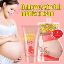 Крем от растяжек для беременных, крем от растяжек и шрамов после родов, крем от ожирения, кремы для беременных- MS