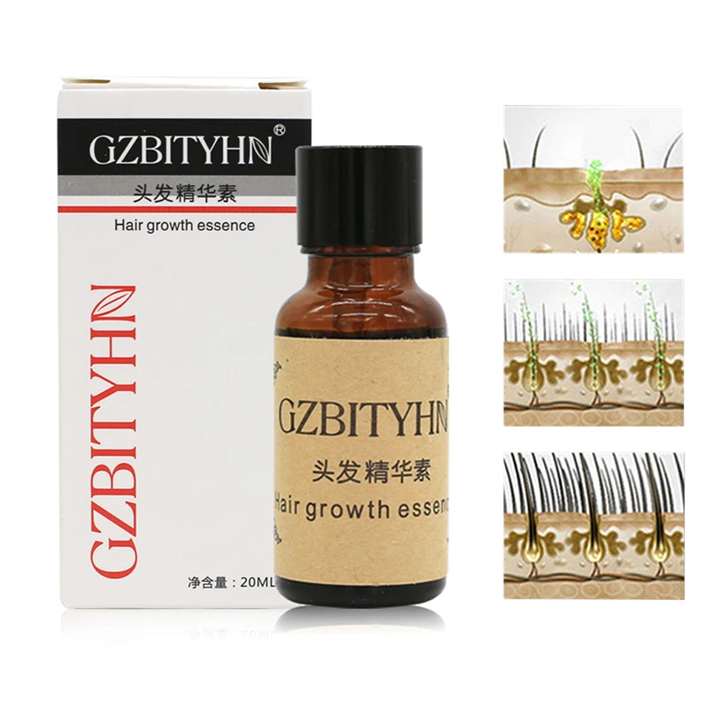 

Fast Hair Growth Pilatory Essence Liquid Human Hair Oil Baldness Anti Hair Loss 20ML